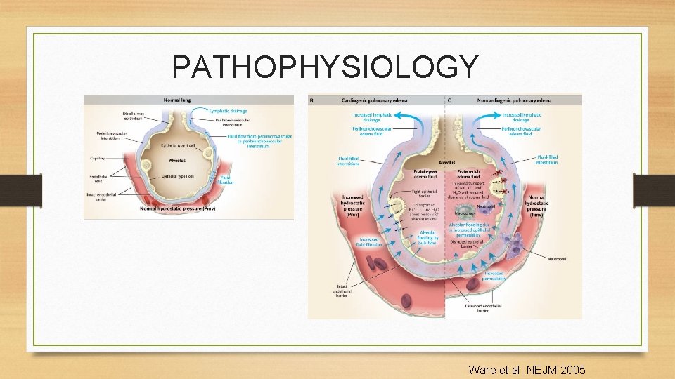 PATHOPHYSIOLOGY Ware et al, NEJM 2005 