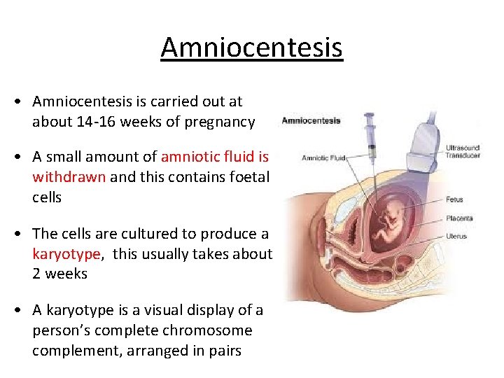 Amniocentesis • Amniocentesis is carried out at about 14 -16 weeks of pregnancy •