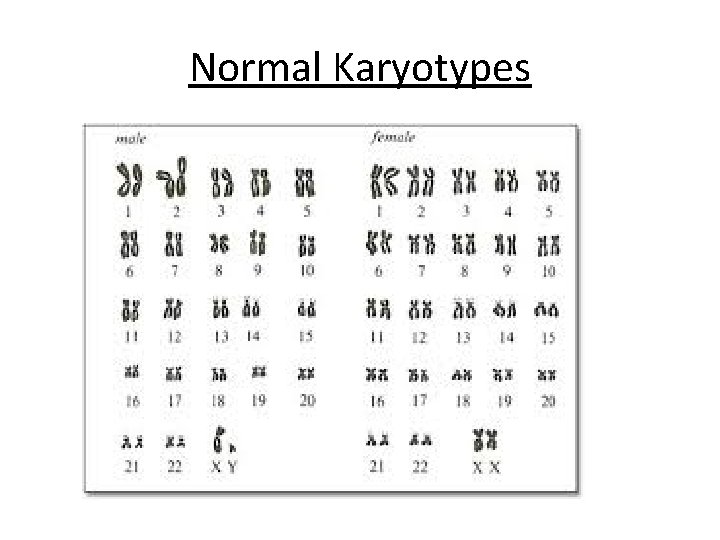 Normal Karyotypes 