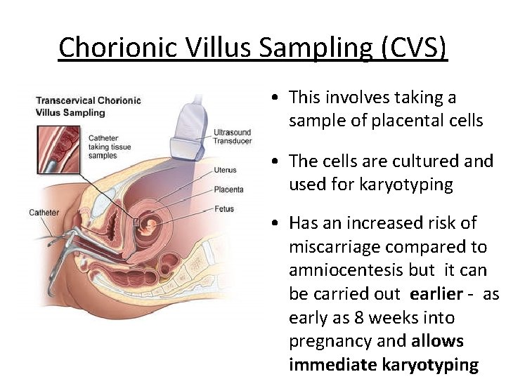 Chorionic Villus Sampling (CVS) • This involves taking a sample of placental cells •