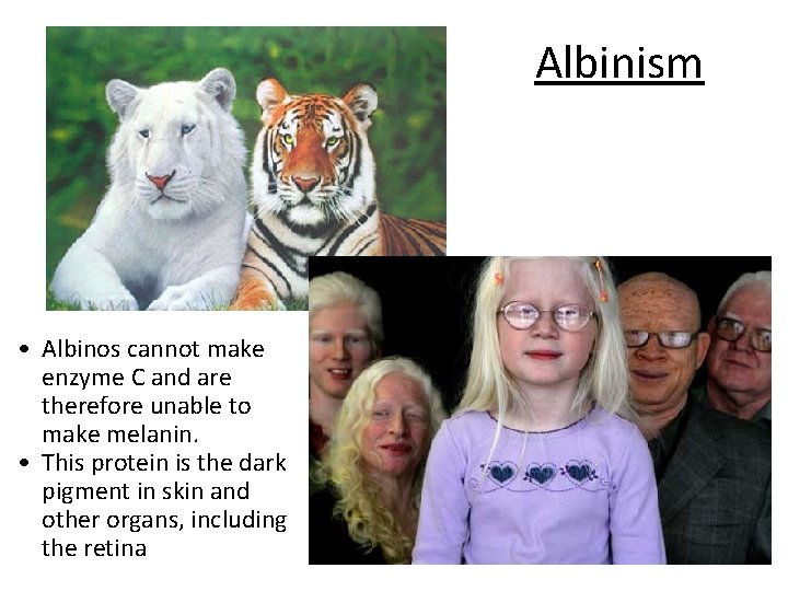 Albinism • Albinos cannot make enzyme C and are therefore unable to make melanin.