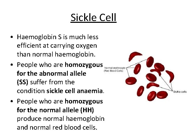 Sickle Cell • Haemoglobin S is much less efficient at carrying oxygen than normal