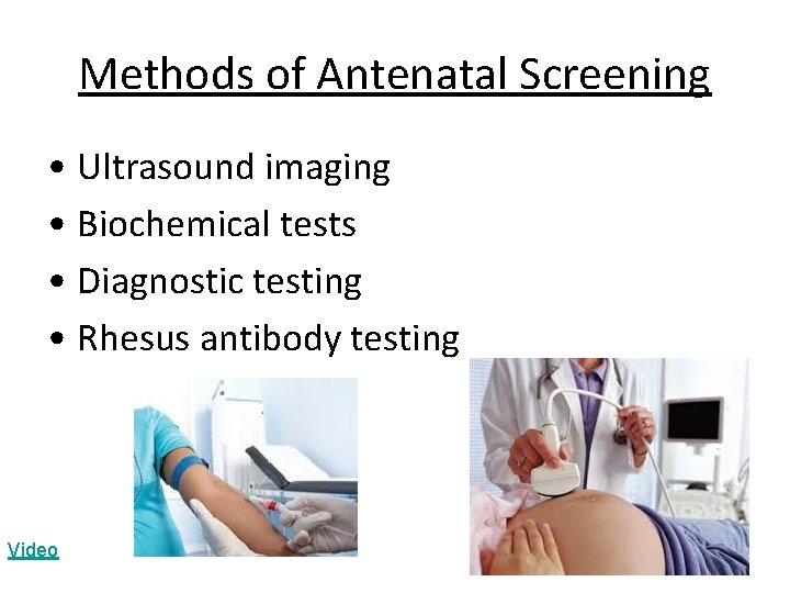 Methods of Antenatal Screening • Ultrasound imaging • Biochemical tests • Diagnostic testing •