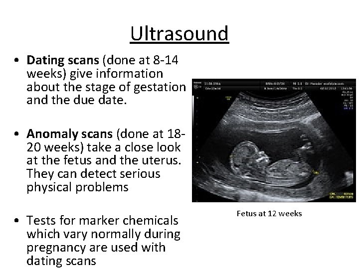 Ultrasound • Dating scans (done at 8 -14 weeks) give information about the stage