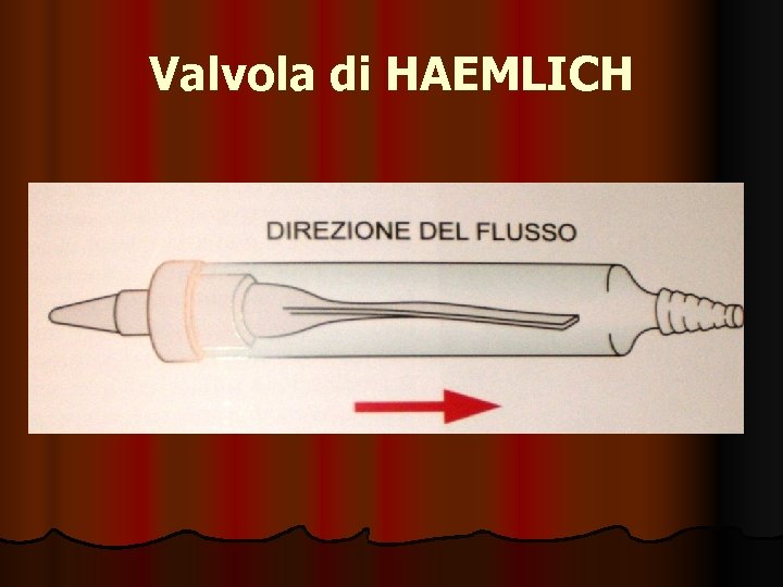 Valvola di HAEMLICH 