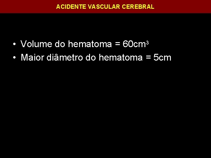 ACIDENTE VASCULAR CEREBRAL • Volume do hematoma = 60 cm 3 • Maior diâmetro