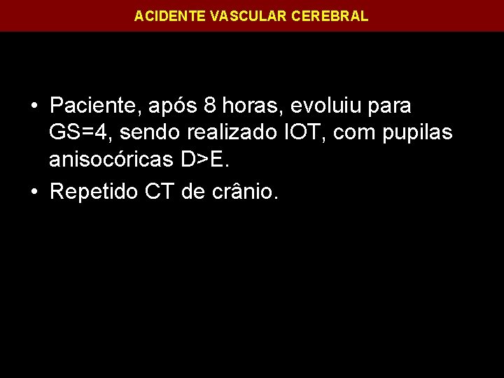 ACIDENTE VASCULAR CEREBRAL • Paciente, após 8 horas, evoluiu para GS=4, sendo realizado IOT,