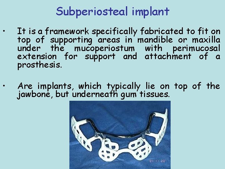 Subperiosteal implant • It is a framework specifically fabricated to fit on top of