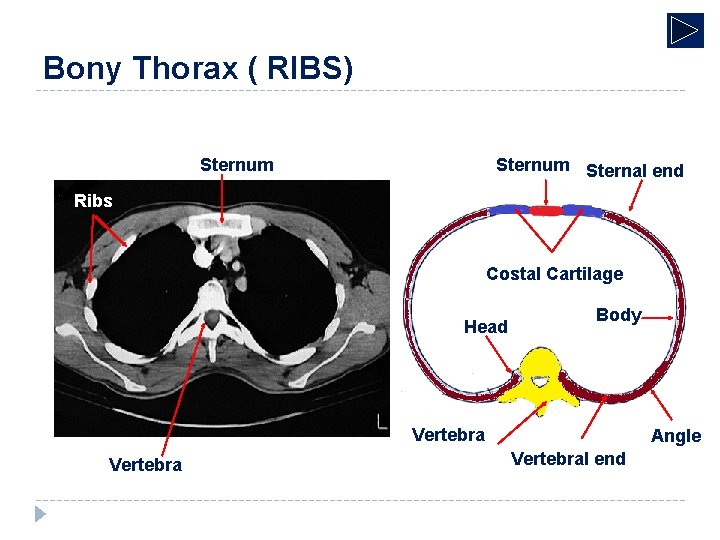 Bony Thorax ( RIBS) Sternum Sternal end Ribs Costal Cartilage Head Body Vertebra Angle