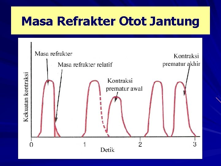 Masa Refrakter Otot Jantung 