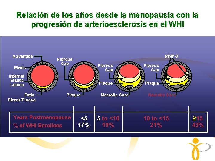 Relación de los años desde la menopausia con la progresión de arterioesclerosis en el Relación de los años desde la menopausia con la progresión de arterioesclerosis en el