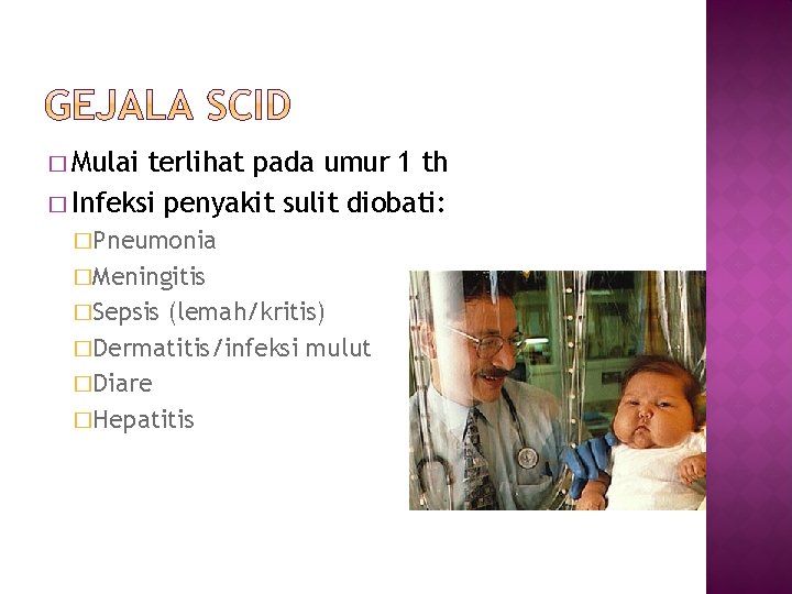 � Mulai terlihat pada umur 1 th � Infeksi penyakit sulit diobati: �Pneumonia �Meningitis