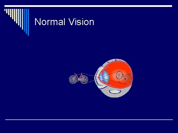 Normal Vision 