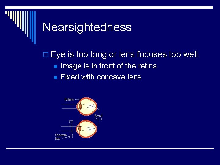 Nearsightedness o Eye is too long or lens focuses too well. n n Image