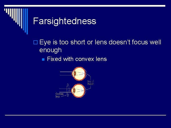 Farsightedness o Eye is too short or lens doesn’t focus well enough n Fixed