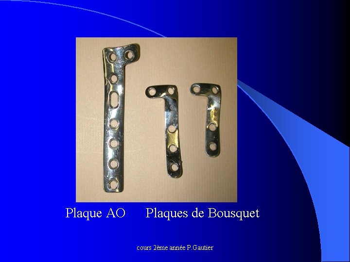 Plaque AO Plaques de Bousquet cours 2ème année P. Gautier 