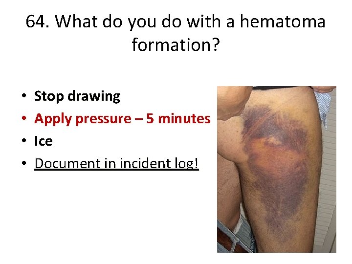 Chapter 9 Preanalytical Considerations OBJECTIVES Define the key