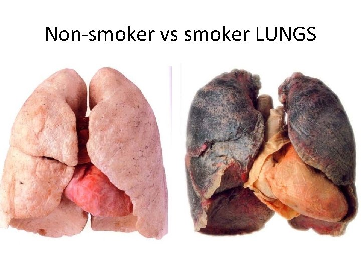 Non-smoker vs smoker LUNGS 