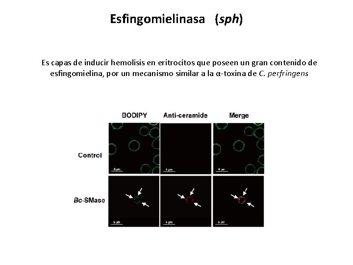 Esfingomielinasa (sph) Es capas de inducir hemolisis en eritrocitos que poseen un gran contenido