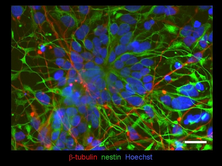 b-tubulin nestin Hoechst 