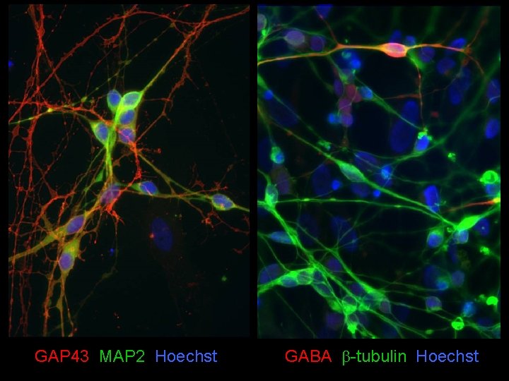 GAP 43 MAP 2 Hoechst GABA b-tubulin Hoechst 