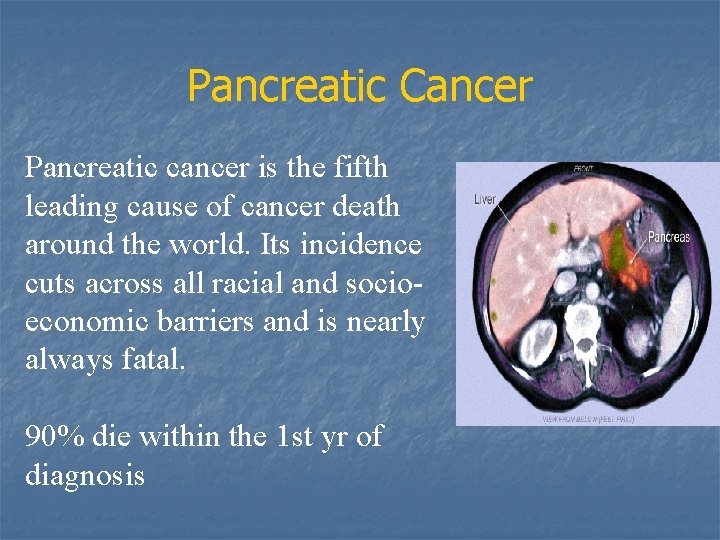 Pancreatic Cancer Pancreatic cancer is the fifth leading cause of cancer death around the