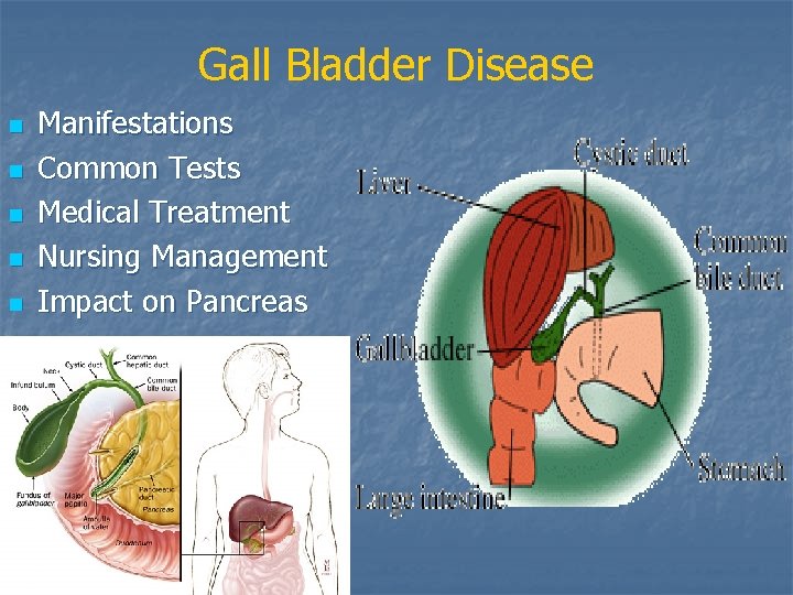 Gall Bladder Disease n n n Manifestations Common Tests Medical Treatment Nursing Management Impact