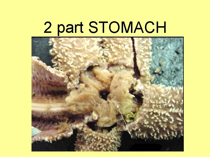 2 part STOMACH 