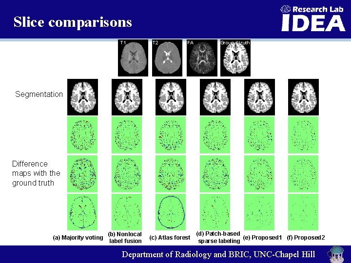 Slice comparisons T 1 T 2 FA Ground truth Segmentation Difference maps with the