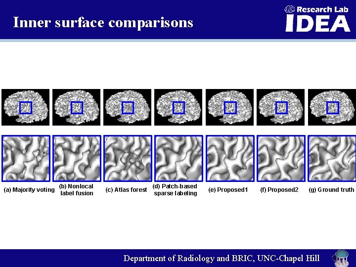 Inner surface comparisons (a) Majority voting (b) Nonlocal label fusion (c) Atlas forest (d)