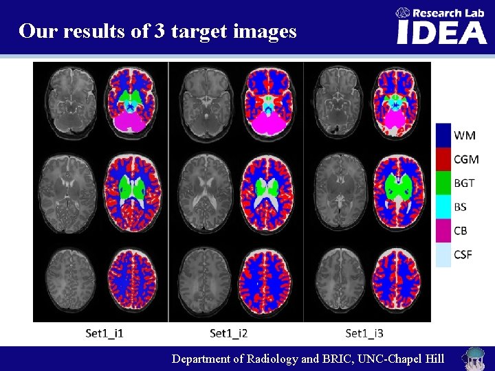 Our results of 3 target images Department of Radiology and BRIC, UNC-Chapel Hill 