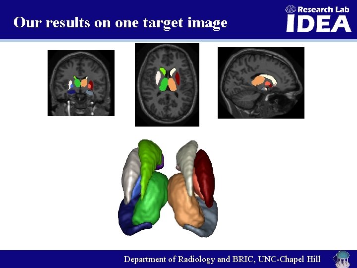 Our results on one target image Department of Radiology and BRIC, UNC-Chapel Hill 