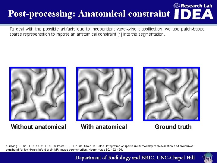 Post-processing: Anatomical constraint To deal with the possible artifacts due to independent voxel-wise classification,