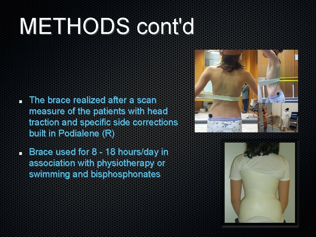 METHODS cont'd The brace realized after a scan measure of the patients with head