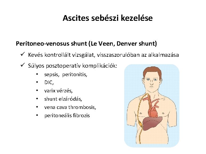 Ascites sebészi kezelése Peritoneo-venosus shunt (Le Veen, Denver shunt) ü Kevés kontrollált vizsgálat, visszaszorulóban