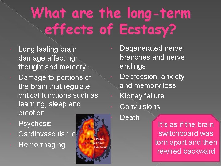 What are the long-term effects of Ecstasy? Long lasting brain damage affecting thought and