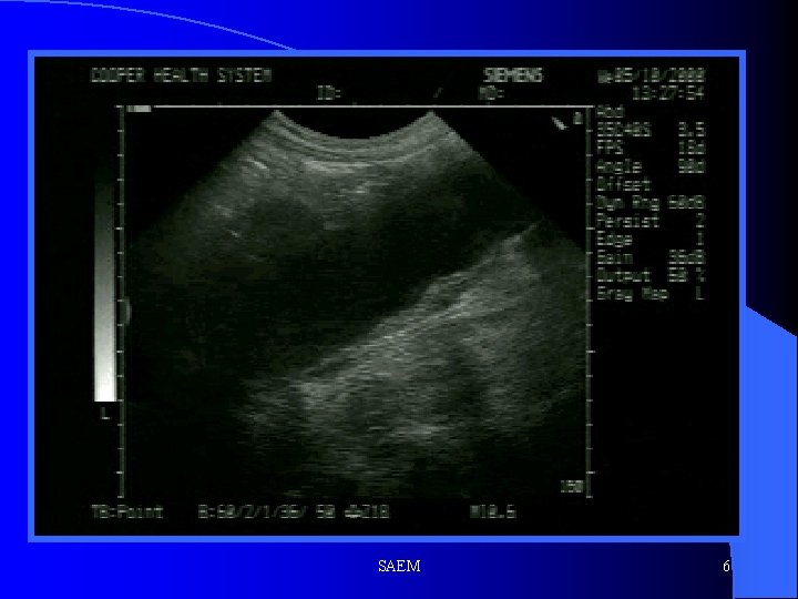 SAEM 6 
