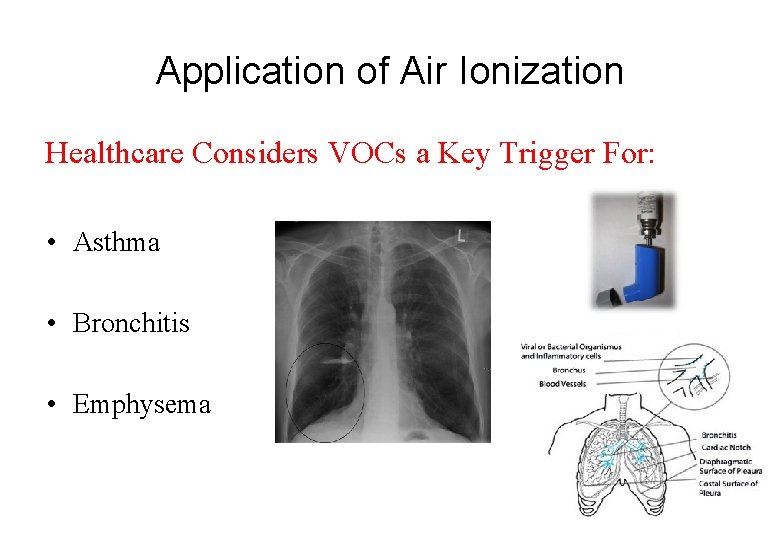 Application of Air Ionization Healthcare Considers VOCs a Key Trigger For: • Asthma •