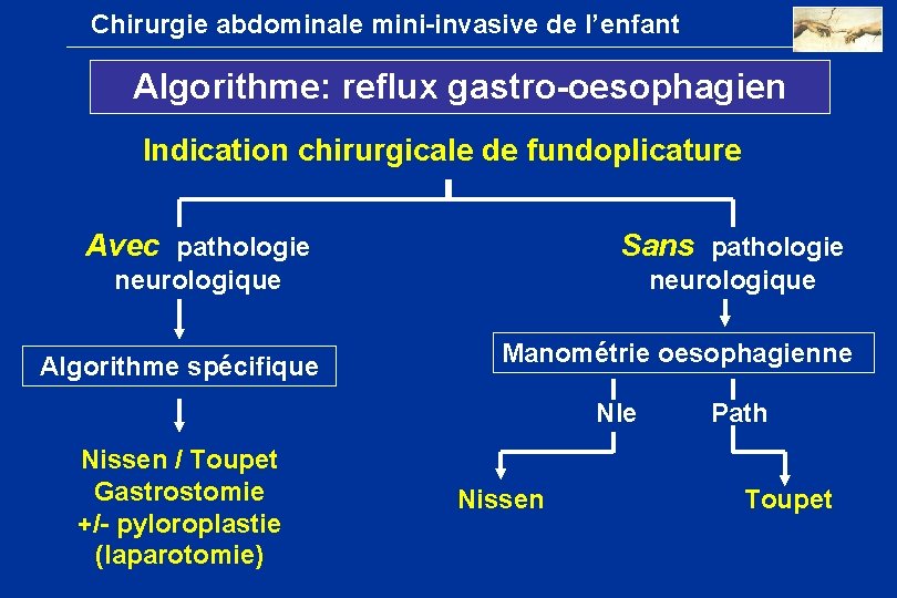 Chirurgie abdominale mini-invasive de l’enfant Algorithme: reflux gastro-oesophagien Indication chirurgicale de fundoplicature Avec pathologie