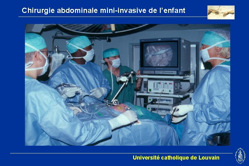 Chirurgie abdominale mini-invasive de l’enfant Université catholique de Louvain 
