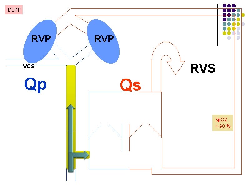 DCPT RVP RVS VCS Qp Qs Sp. O 2 100 % < 90 %