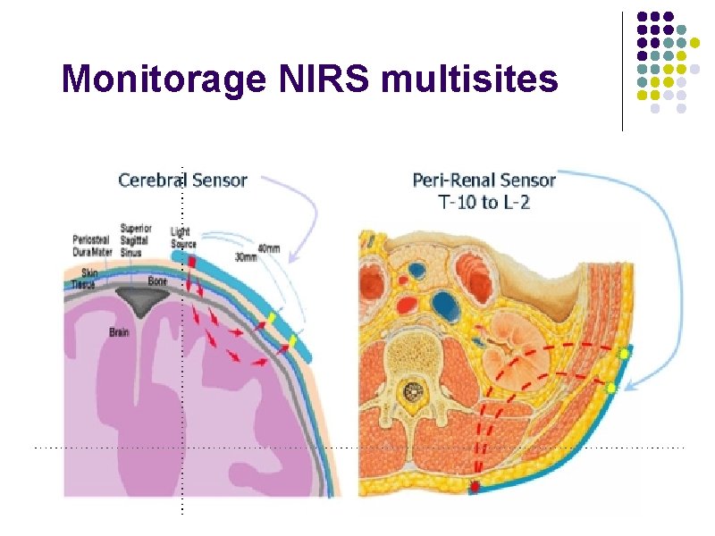 Monitorage NIRS multisites 