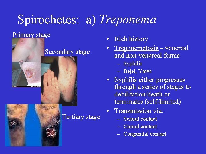 Spirochetes: a) Treponema Primary stage Secondary stage • Rich history • Treponematosis – venereal