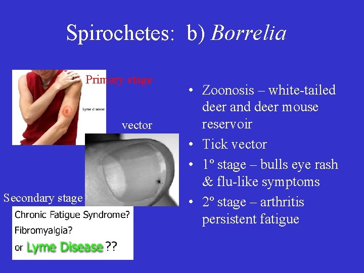 Spirochetes: b) Borrelia Primary stage vector Secondary stage • Zoonosis – white-tailed deer and