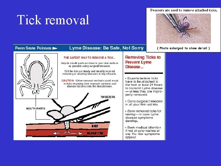 Tick removal 