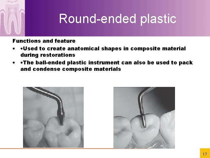 Round-ended plastic Functions and feature • • Used to create anatomical shapes in composite