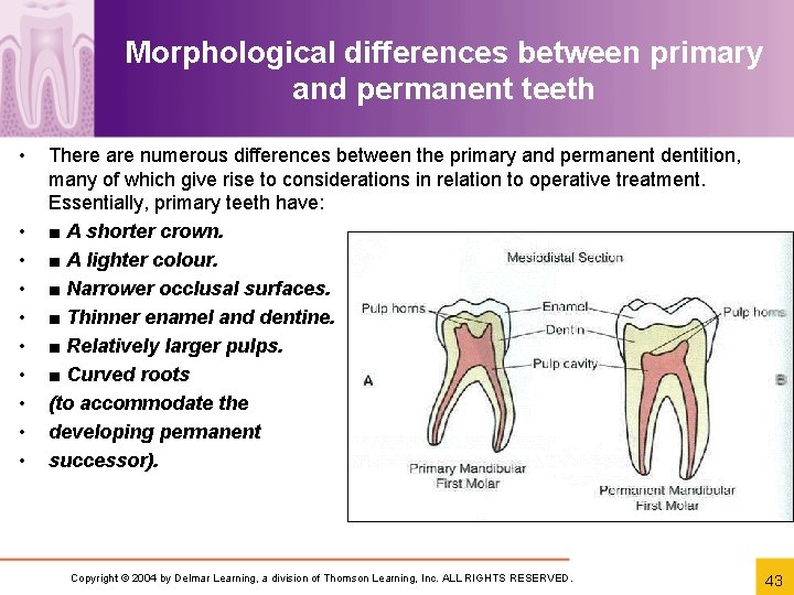 Morphological differences between primary and permanent teeth • • • There are numerous differences