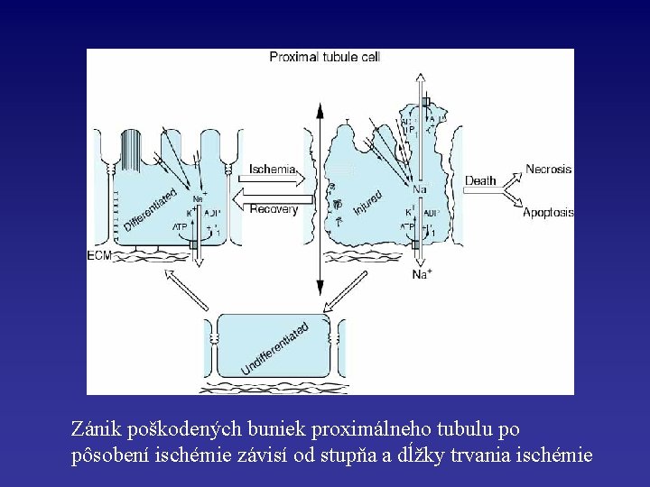 Zánik poškodených buniek proximálneho tubulu po pôsobení ischémie závisí od stupňa a dĺžky trvania