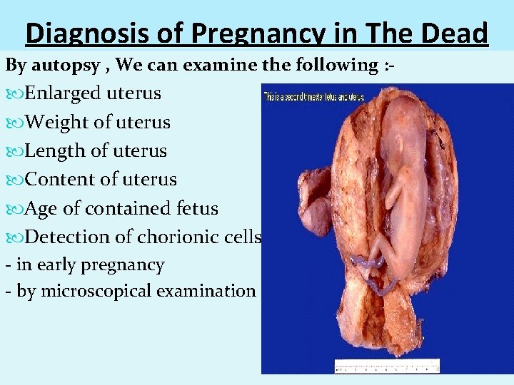 Diagnosis of Pregnancy in The Dead By autopsy , We can examine the following