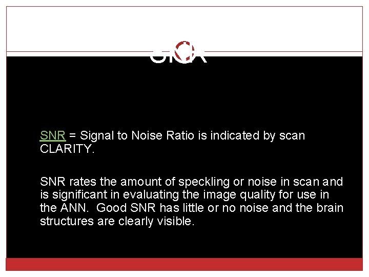 SNR = Signal to Noise Ratio is indicated by scan CLARITY. SNR rates the